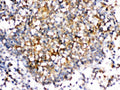 Anti-CD153/TNFSF8 Antibody