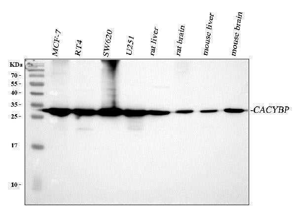 Anti-SIAH Interacting Protein/CACYBP Antibody Picoband®