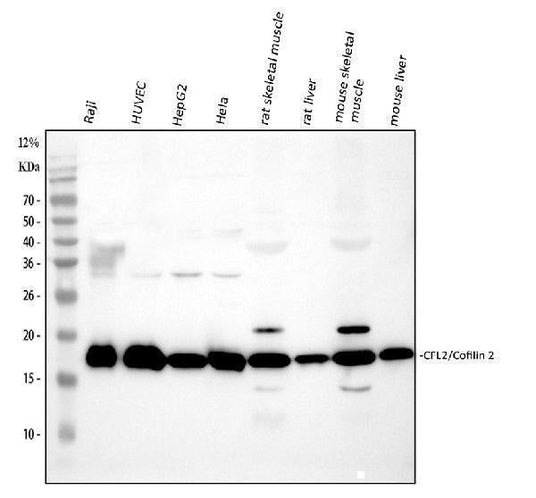 Anti-Cofilin 2/CFL2 Antibody Picoband®