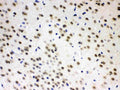 Anti-L-Arginine decarboxylase/AZIN2 Antibody Picoband®
