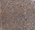 LIPE Polyclonal Antibody – Figure 1 of 3