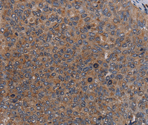 LIPE Polyclonal Antibody – Figure 1 of 3