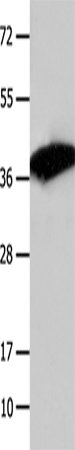 COPS5 Polyclonal Antibody – Figure 1 of 3