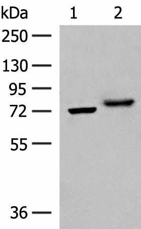 POMGNT1 Polyclonal Antibody – Figure 1 of 3