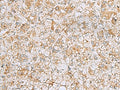 FERMT1 Polyclonal Antibody – Figure 1 of 2