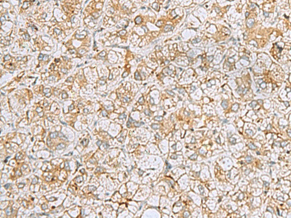 FERMT1 Polyclonal Antibody – Figure 1 of 2