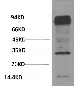 HIF1 bata Monoclonal Antibody – Figure 1 of 3