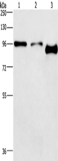 PIP5K1C Polyclonal Antibody – Figure 1 of 2