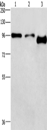 PIP5K1C Polyclonal Antibody – Figure 1 of 2