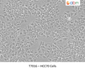 HCC70 Cells – Figure 1 of 1