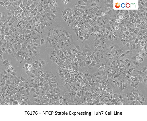 NTCP Stable Expressing Huh7 Cell Line | Applied Biological Materials (abm)