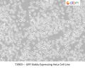 GFP Stably Expressing HeLa Cell Line | Applied Biological Materials (abm)