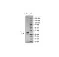4-20% SDS-PAGE Coomassie Staining