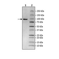 UBE3A, His-FLAG-tags Recombinant – Figure 1 of 1