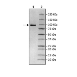 UBE3A, His-FLAG-tags Recombinant – Figure 1 of 1