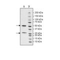 Anti-Beta NGF (Nerve Growth Factor) Neutralizing Antibody – Figure 1 of 2
