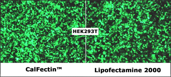 CalFectin™ Mammalian Cell Transfection Reagent – transfected HEK293T cells vs Lipofectamine 2000