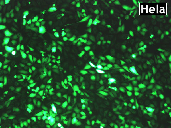 GenJet™ In Vitro DNA Transfection Reagent for HeLa Cells – GFP transfection in HeLa cells