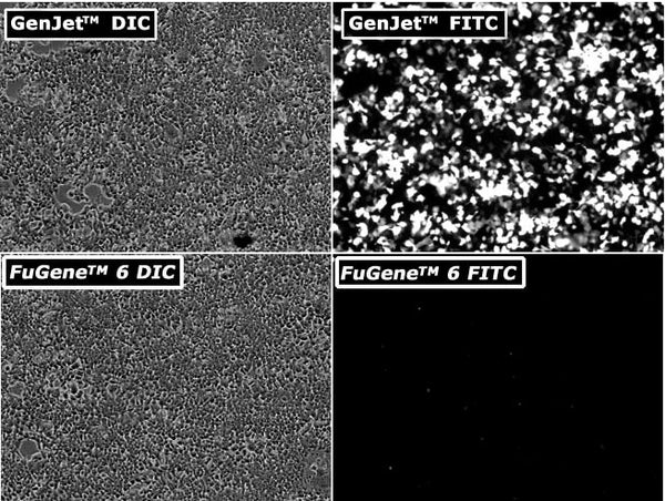 GenJet™ In Vitro DNA Transfection Reagent – 14 kb GFP-tagged DNA transfection in HEK293 cells vs FuGene™ 6