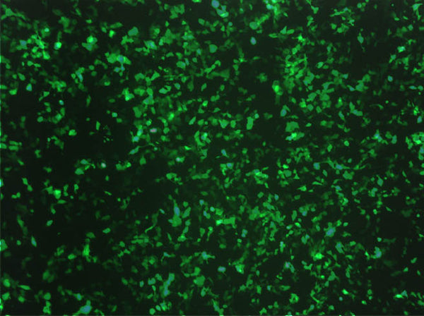 GenJet™ In Vitro DNA Transfection Reagent for MDCK Cells – GFP transfection in MDCK cells