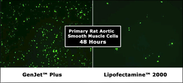 GenJet™ Plus DNA In Vitro Transfection Reagent – nuclear GFP in primary rat aortic smooth muscle cells vs L2K
