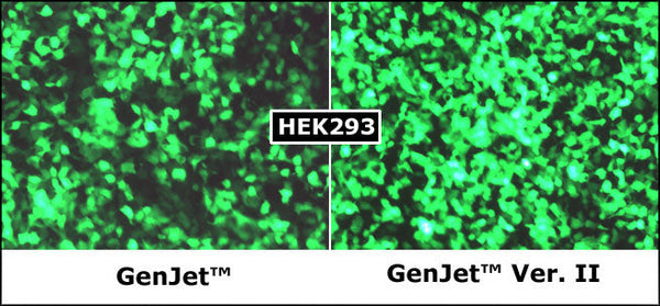 GenJet™ In Vitro DNA Transfection Reagent (Ver. II) – GFP transfection vs original GenJet™ in 293T and HeLa cells