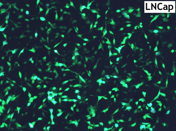 GenJet™ In Vitro DNA Transfection Reagent for LNCaP Cells – GFP transfection in LNCaP cells