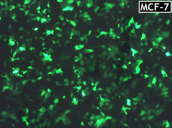 GenJet™ In Vitro DNA Transfection Reagent for MCF-7 Cells – GFP transfection in MCF-7 cells