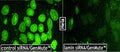 GenMute™ siRNA Transfection Reagent – lamin siRNA knockdown in HeLa cells