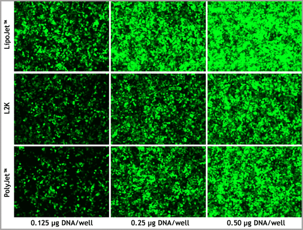 LipoJet™ In Vitro Transfection Kit (Ver. II) – GFP transfection in HEK293T cells vs Lipofectamine 2000 and PolyJet™