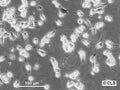 SK-UT-1B cell