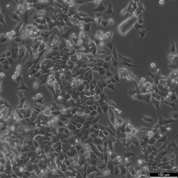 SNU-398 cell