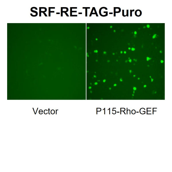 SRF-RE Reporter Lentivirus – Figure 1