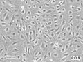 SVI cell