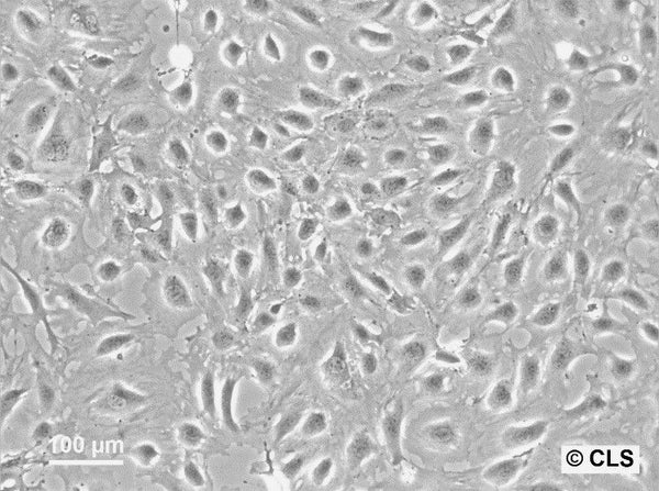 SVI cell