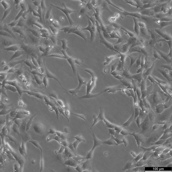 SW-982 cell