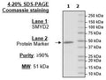 SMYD2 (KMT3C), FLAG-tag Recombinant – Figure 1 of 2