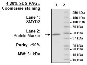SMYD2 (KMT3C), FLAG-tag Recombinant – Figure 1 of 2