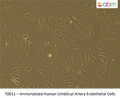 Immortalized Human Umbilical Artery Endothelial Cells | Applied Biological Materials (abm)