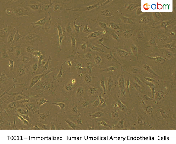 Immortalized Human Umbilical Artery Endothelial Cells | Applied Biological Materials (abm)