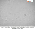 Immortalized Human Cord Blood Mesenchymal Stromal Cells with RFP (cbMSC-hTERT-RFP) | Applied Biological Materials (abm)