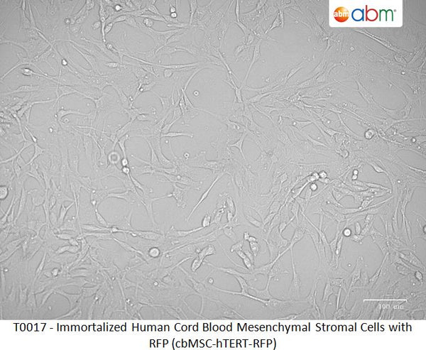 Immortalized Human Cord Blood Mesenchymal Stromal Cells with RFP (cbMSC-hTERT-RFP) | Applied Biological Materials (abm)