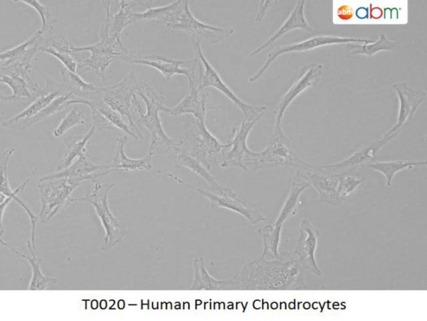 Human Primary Chondrocytes | Applied Biological Materials (abm)