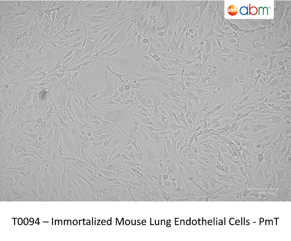 Immortalized Mouse Lung Endothelial Cells - PmT | Applied Biological Materials (abm)