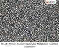 Primary Human Hepatocytes, Metabolism Qualified, Suspension | Applied Biological Materials (abm)