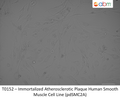 Immortalized Atherosclerotic Plaque Human Smooth Muscle Cell Line (pdSMC2A) | Applied Biological Materials (abm)