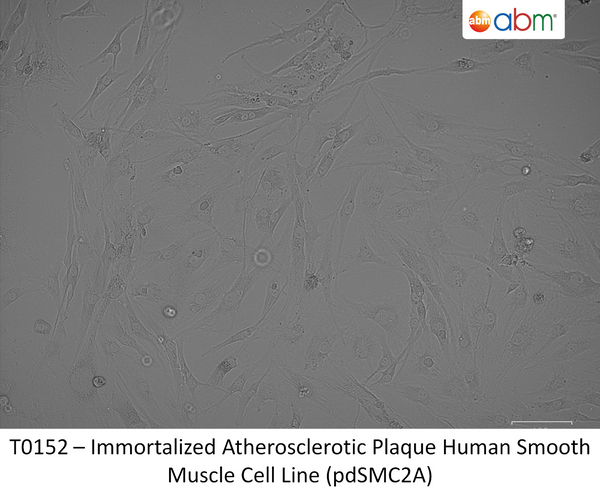 Immortalized Atherosclerotic Plaque Human Smooth Muscle Cell Line (pdSMC2A) | Applied Biological Materials (abm)