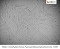 Immortalized Human Pancreatic Mesenchymal Stem Cells - hTERT | Applied Biological Materials (abm)