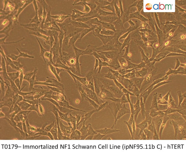 Immortalized NF1 Schwann Cell Line (ipNF95.11b C) - hTERT | Applied Biological Materials (abm)