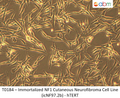 Immortalized NF1 Cutaneous Neurofibroma Cell Line (icNF97.2b) - hTERT | Applied Biological Materials (abm)
